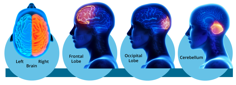 PI and brain activation